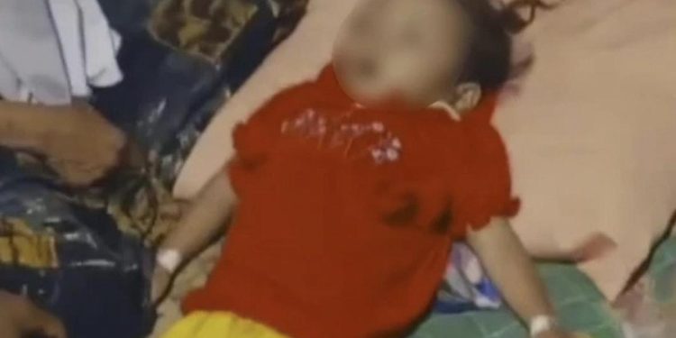 Pascakasus Bocah Sukabumi Kecacingan, Kemenkes Lakukan Penyelidikan Epidemiologi