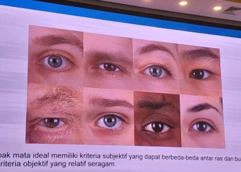 Mau Punya Lipatan Mata? Boleh tapi Jangan Lupa Fungsi Utama Kelopak Mata