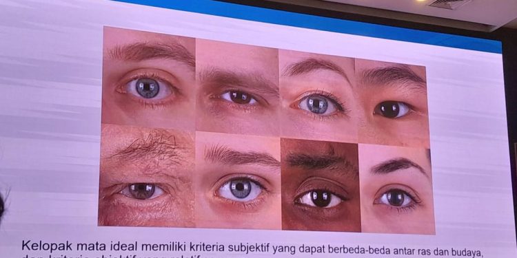 Mau Punya Lipatan Mata? Boleh tapi Jangan Lupa Fungsi Utama Kelopak Mata