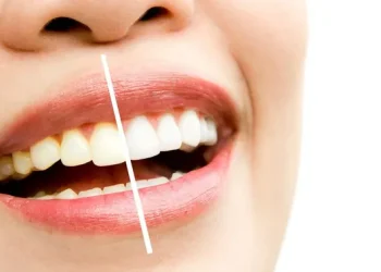 Gigi Kuning Bukan Hanya karena Kopi, Ini 5 Kebiasaan Penyebab Senyum Tak Cerah