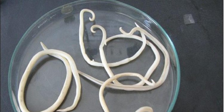 Cacing Gelang Menginfeksi Anak di Sukabumi dengan Panjang hingga 35 Cm