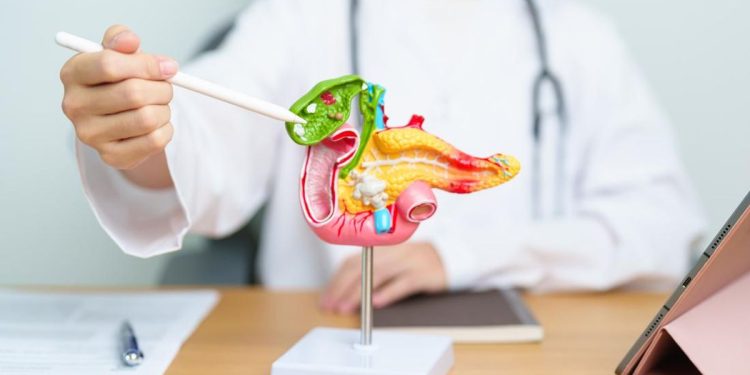 6 Makanan Ampuh Mengatasi Batu Empedu