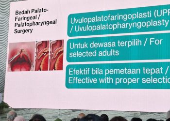 Mendengkur Tidak Menyebabkan Tidur Nyenyak menurut Dokter