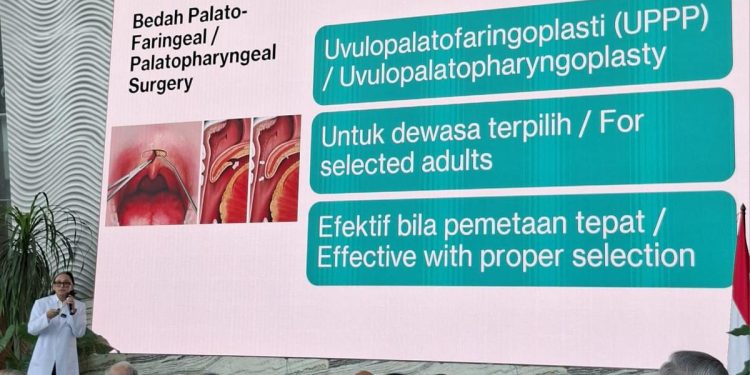 Mendengkur Tidak Menyebabkan Tidur Nyenyak menurut Dokter