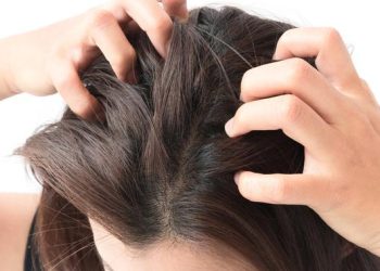 Penyebab Jerawat di Kulit Kepala dan Solusinya