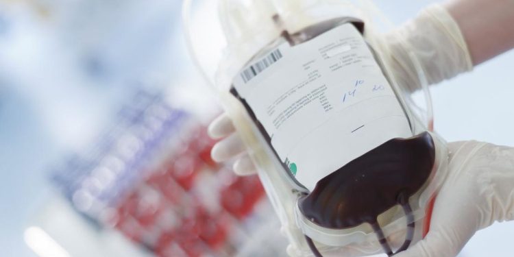 Mengenal Golden Blood, Jenis Darah yang Hanya Dimiliki 50 Orang di Dunia