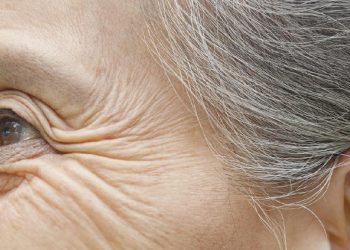 7 Penyebab Keriput di Bawah Mata yang Mempercepat Tampak Tua