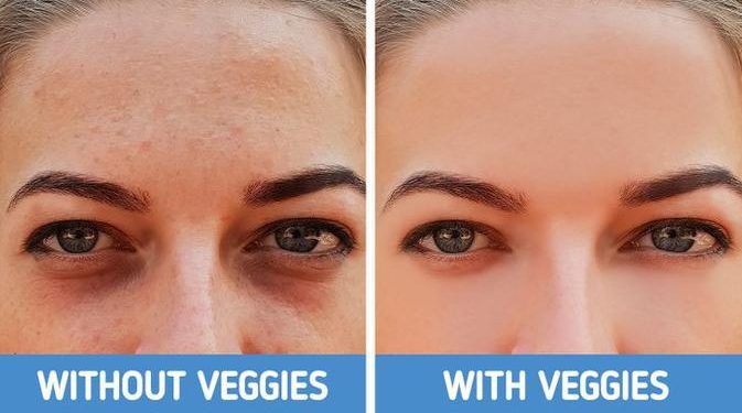 Kenali 4 Tipe Lingkaran Hitam di Bawah Mata dan Cara Efektif Mengatasinya